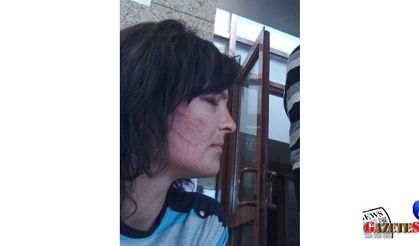 Doctor fined over inaccurate report on tortured woman in Turkey's west